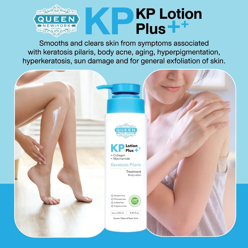 QUEEN KP Body Acne Keratosis Pilaris Exfoliating Body Lotion Plus Collagen Niacinamide